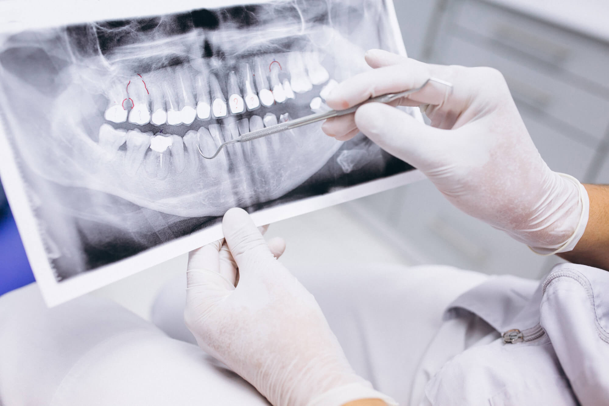 radiografia dental